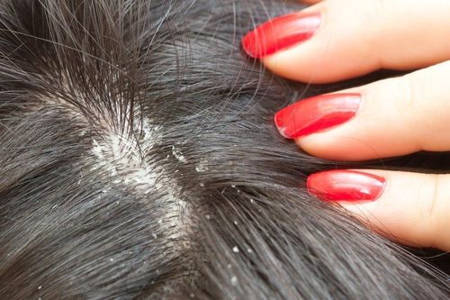 Nhập viện khẩn cấp sau khi ủ tóc diệt chấy