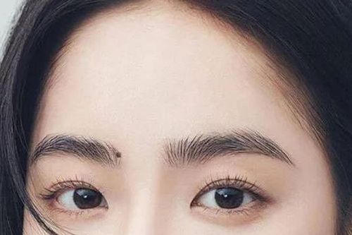 4 nốt ruồi ẩn mang phúc khí trời ban: Cả đời sung túc, an nhàn