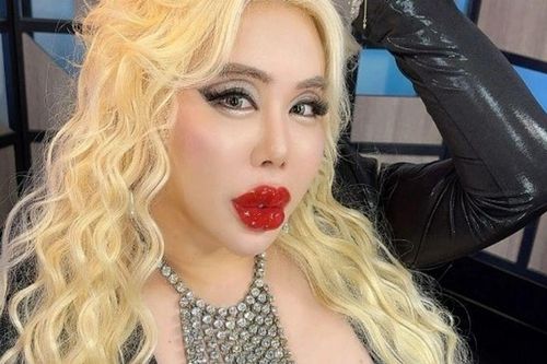 Bị bắt nạt từ nhỏ, chàng trai chi hơn 17 tỷ đồng để biến thành 'người đẹp nhất thế giới'