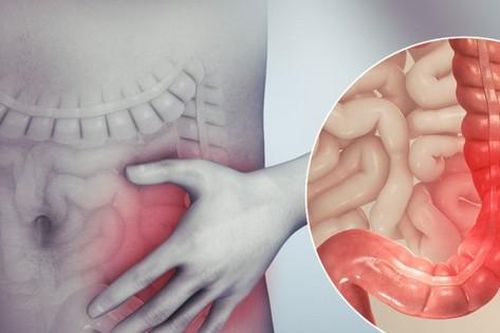 Viêm đại tràng co thắt có nguy hiểm không?