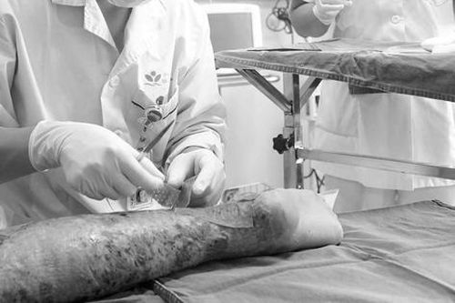 Bé trai 12 tuổi hét thất thanh, bố mẹ chạy vào thấy cảnh tượng 'đáng sợ'