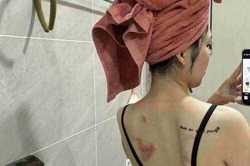 Tâm sự đắng chát của người vợ bị chồng đánh thủng màng nhĩ, chấn động não: Tiết lộ 1 chi tiết bất ngờ về gia đình chồng