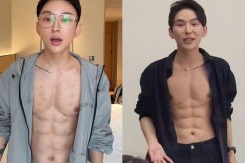 Người đàn ông chi hơn 14 tỷ đồng tiêm 10.000 liều axit tạo cơ bụng 8 múi