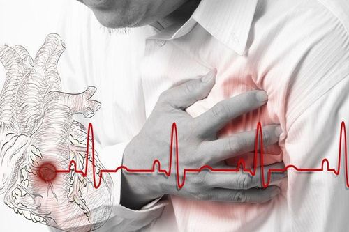 Tính cách và cảm xúc ảnh hưởng tới nguy cơ đột quỵ
