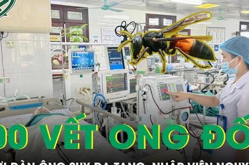 Hơn 100 vết ong vò vẽ đốt khiến người đàn ông suy đa tạng, nhập viện nguy kịch