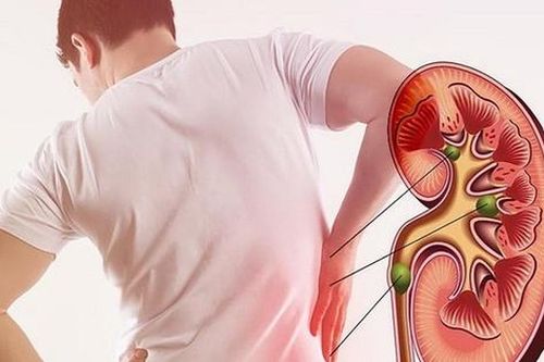 Người bệnh thận mạn tính cần thận trọng với những loại thuốc nào?