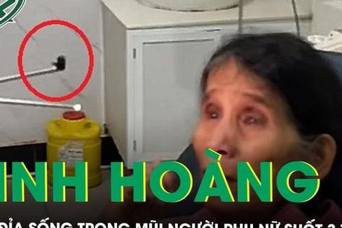 Kinh hoàng con đỉa sống trong mũi người phụ nữ suốt 3 tuần