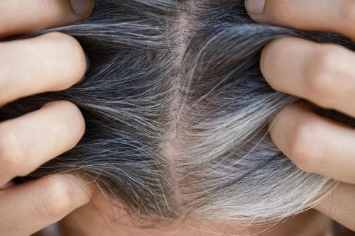 Mối liên quan giữa tóc bạc và nguy cơ ung thư