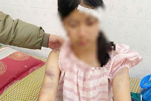 Làm rõ vụ bạo hành trẻ em ở phường Linh Sơn