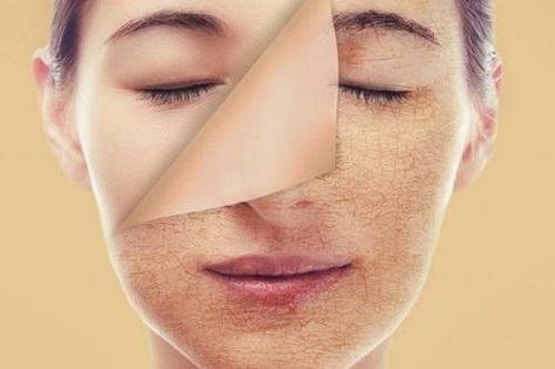Cách chăm sóc da mùa đông phòng nứt nẻ