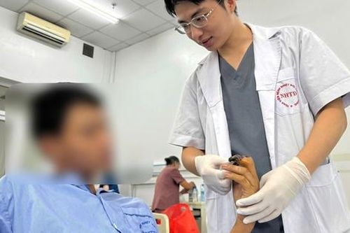 Máy cắt làm lóc da 3 ngón tay, hoại tử xương