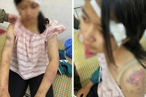 Xác minh, làm rõ việc bé gái 13 tuổi bị ông bà bạo hành đến mức nhập viện cấp cứu