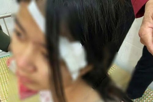 Hoàn cảnh éo le của bé gái 13 tuổi bị bà nội và hai người đàn ông tra khảo, đánh đập