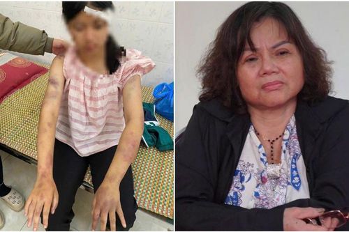 Bé gái 13 tuổi ở Thái Nguyên bị ông bà đánh dã man, biết nguồn cơn ai nấy càng bức xúc