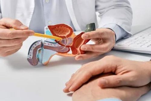 Xét nghiệm phát hiện sớm ung thư tuyến tiền liệt?