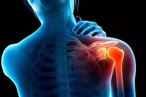 5 bài tập dễ dàng giúp giảm đau vai