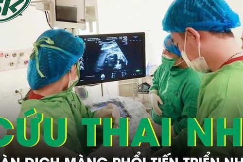 Nỗ lực phút cuối cứu thai nhi 25 tuần tuổi tràn dịch màng phổi tiến triển nhanh
