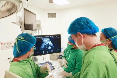 Hành trình hồi sinh cho thai nhi 25 tuần tuổi bị tràn dịch màng phổi hai bên