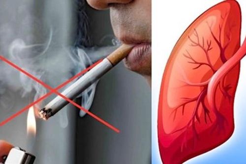 Hút thuốc lá - con đường ngắn nhất dẫn tới ung thư