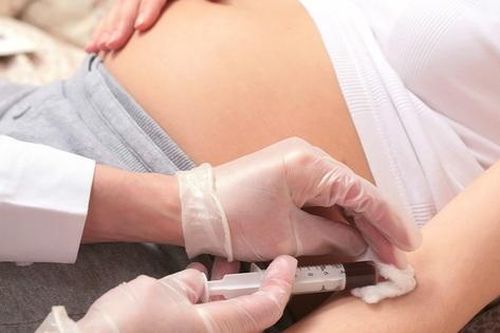 Các xét nghiệm sàng lọc trước sinh Hội chứng Down