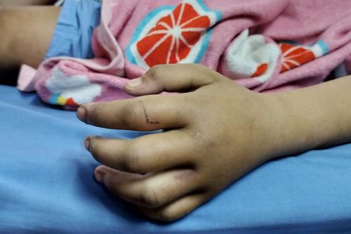 Hội Bảo vệ Quyền trẻ em Việt Nam: 'Vụ bạo hành bé gái 13 tuổi quá dã man, mất nhân tính'