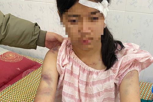 Cựu điều tra viên lý giải các tình tiết tăng nặng trong vụ bé gái 13 tuổi bị ông bà bạo hành