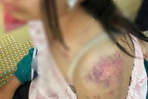 Góc pháp lý vụ bà nội bạo hành cháu gái ở Thái Nguyên
