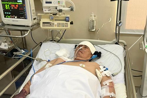 Người phụ nữ có nguy cơ cắt bỏ tứ chi vì nhiễm MRSA cần giúp đỡ