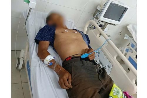 Gia Lai: Một bệnh nhân nguy kịch sau khi ăn bọ xít
