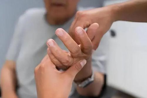 Dấu hiệu thầm lặng cảnh báo tắc nghẽn mạch máu