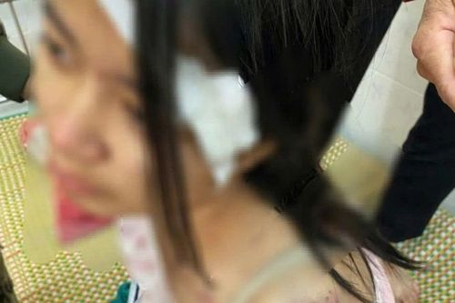 Kết quả giám định thương tật bé gái bị bà nội và 2 người đàn ông hành hạ