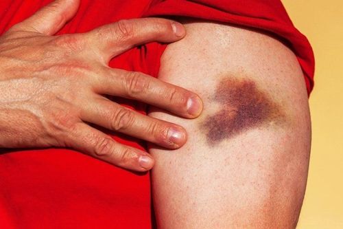 Dấu hiệu bệnh tiểu đường biểu hiện trên da