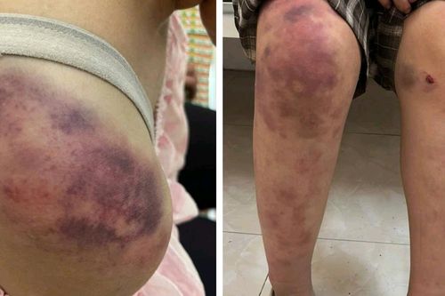 Vụ bé gái 13 tuổi bị ông bà bạo hành ở Thái Nguyên: Lời tâm sự xót xa của bà ngoại