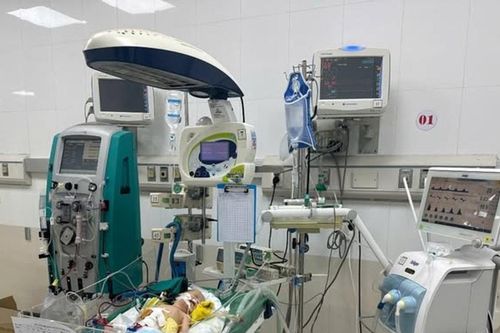 Cứu sống trẻ sơ sinh 3 ngày tuổi bị viêm phúc mạc do thủng ruột
