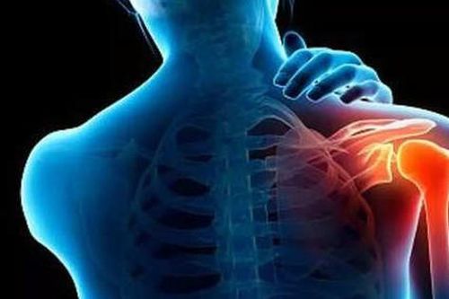 Bài tập nào giảm đau vai nhanh?