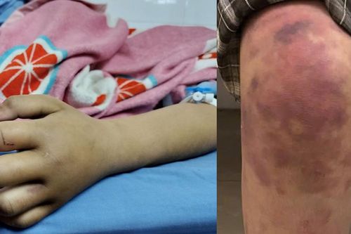 Bé gái 13 tuổi ở Thái Nguyên bị bạo hành: Lời nhắc nhở mạnh mẽ về trách nhiệm của chính quyền cơ sở