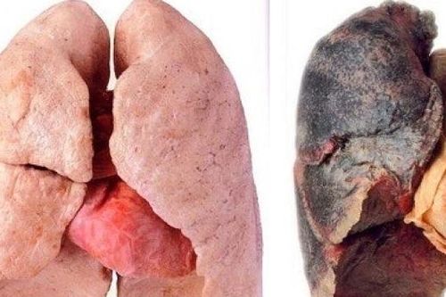 Hơn 230 người Việt tử vong mỗi ngày vì thuốc lá