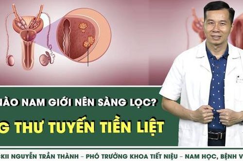 Khi nào nên khám sàng lọc ung thư tuyến tiền liệt?