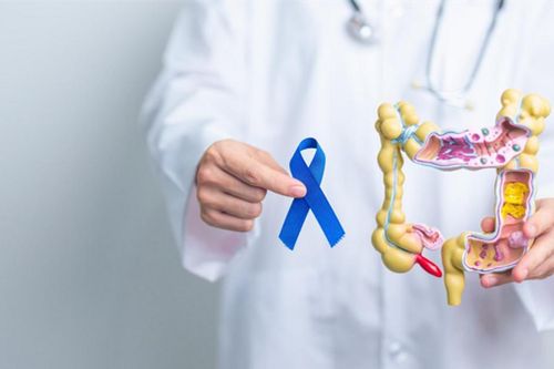 Vì sao người trẻ mắc ung thư đại tràng ngày càng nhiều?
