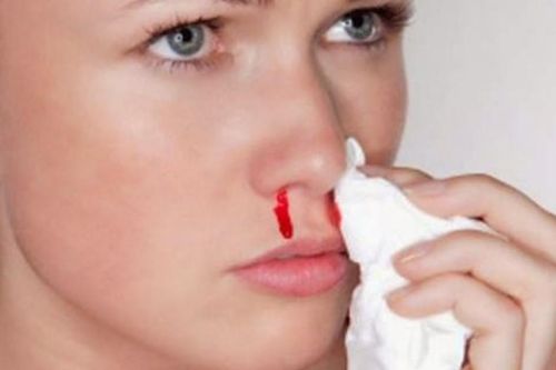 Khô mũi, chảy máu mũi trong ngày hanh khô: Cách chăm sóc và ngăn ngừa hiệu quả