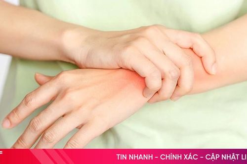 Cách giảm đau nhức xương khớp lúc thay đổi thời tiết