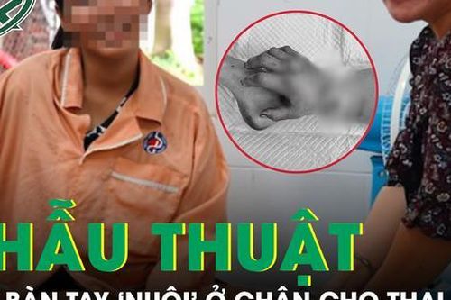 Nối lại bàn tay cho thai phụ mang song thai 34 tuần sau 2 tháng 'nuôi' ở chân