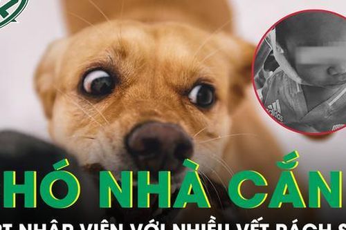 Tưởng chó nhà vô hại, bé trai 2 tuổi bị cắn rách mặt khi đang nô đùa