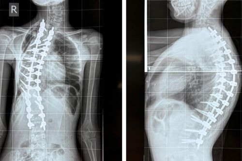 Bé gái mắc bệnh hiếm, bác sĩ BV Nhi đồng 1 lần đầu gặp