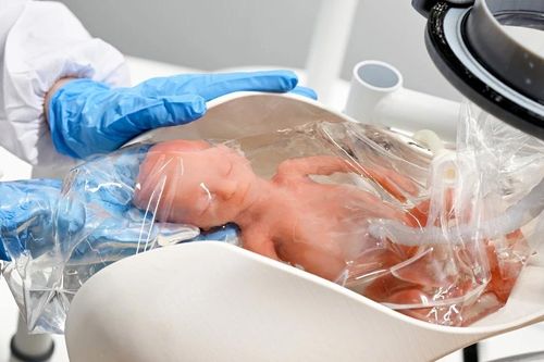 Tử cung nhân tạo: Bước ngoặt y học cứu sống trẻ sinh non