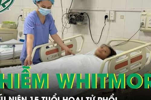 Thiếu niên 15 tuổi nguy kịch vì nhiễm Whitmore gây hoại tử phổi