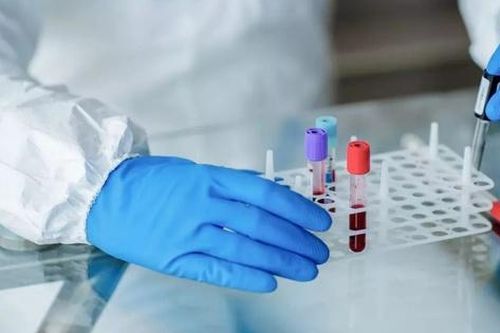Liệu có phương pháp chữa khỏi HIV? Nghiên cứu mới mở ra hy vọng kiểm soát virus không cần dùng thuốc hàng ngày