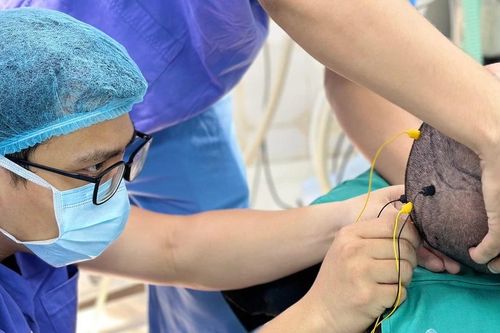Đặt điện cực định vị cắt khối u thần kinh đệm kích thước lớn 8cm trong não
