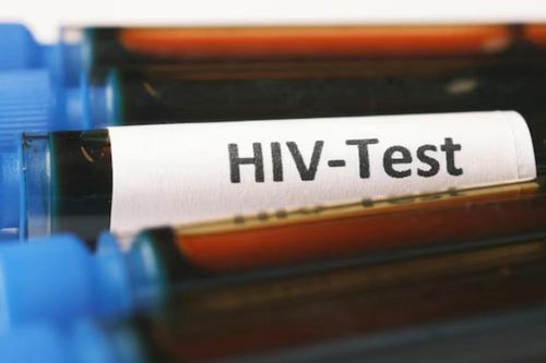 Hướng đi mới hứa hẹn chữa khỏi hẳn HIV