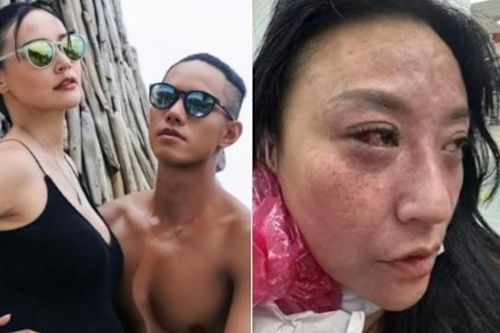 Diễn viên Tâm Vân bị chồng kém 16 tuổi bạo hành